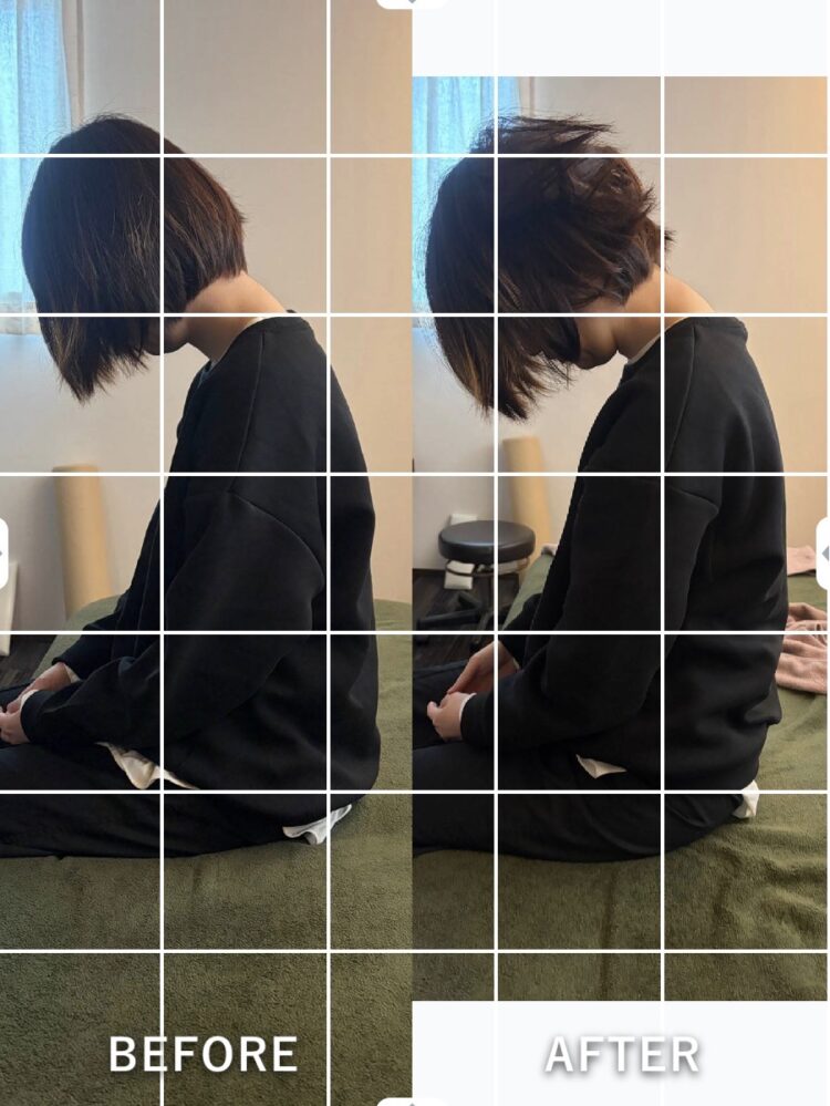 ビフォーアフター