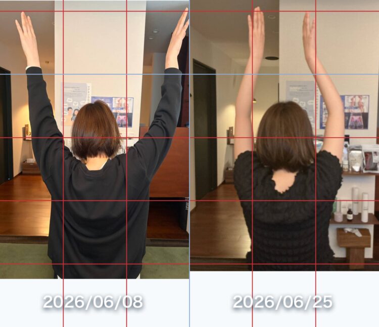ビフォーアフター